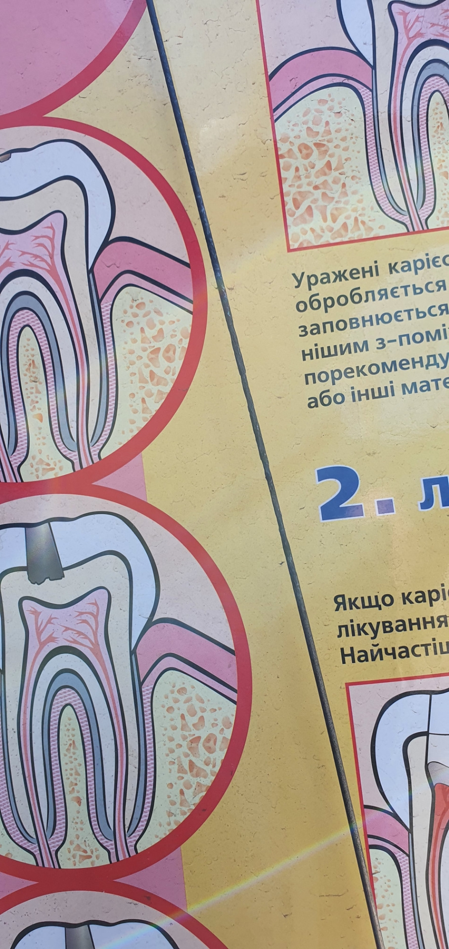 Усього трохи 5