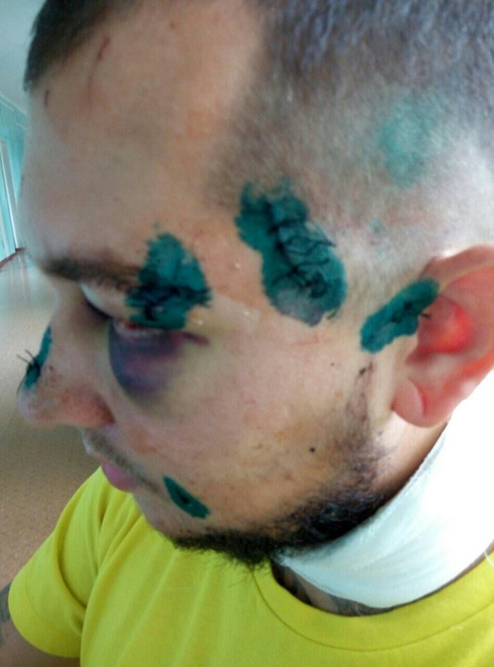 14 ножових поранень від пасажира 2