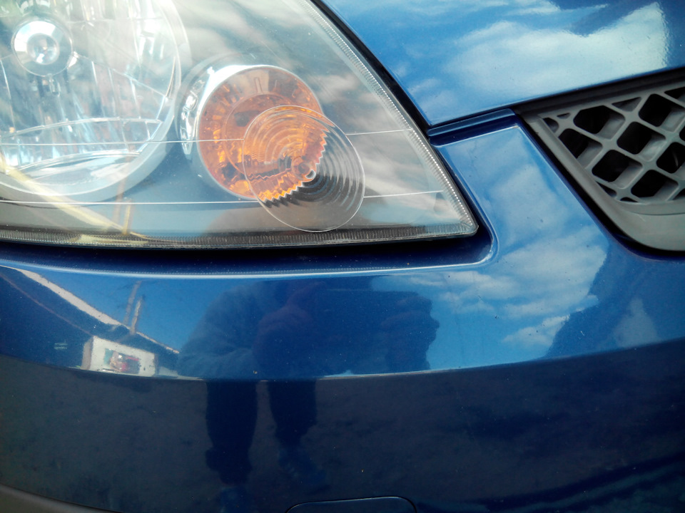 лікування провисання бампера 1