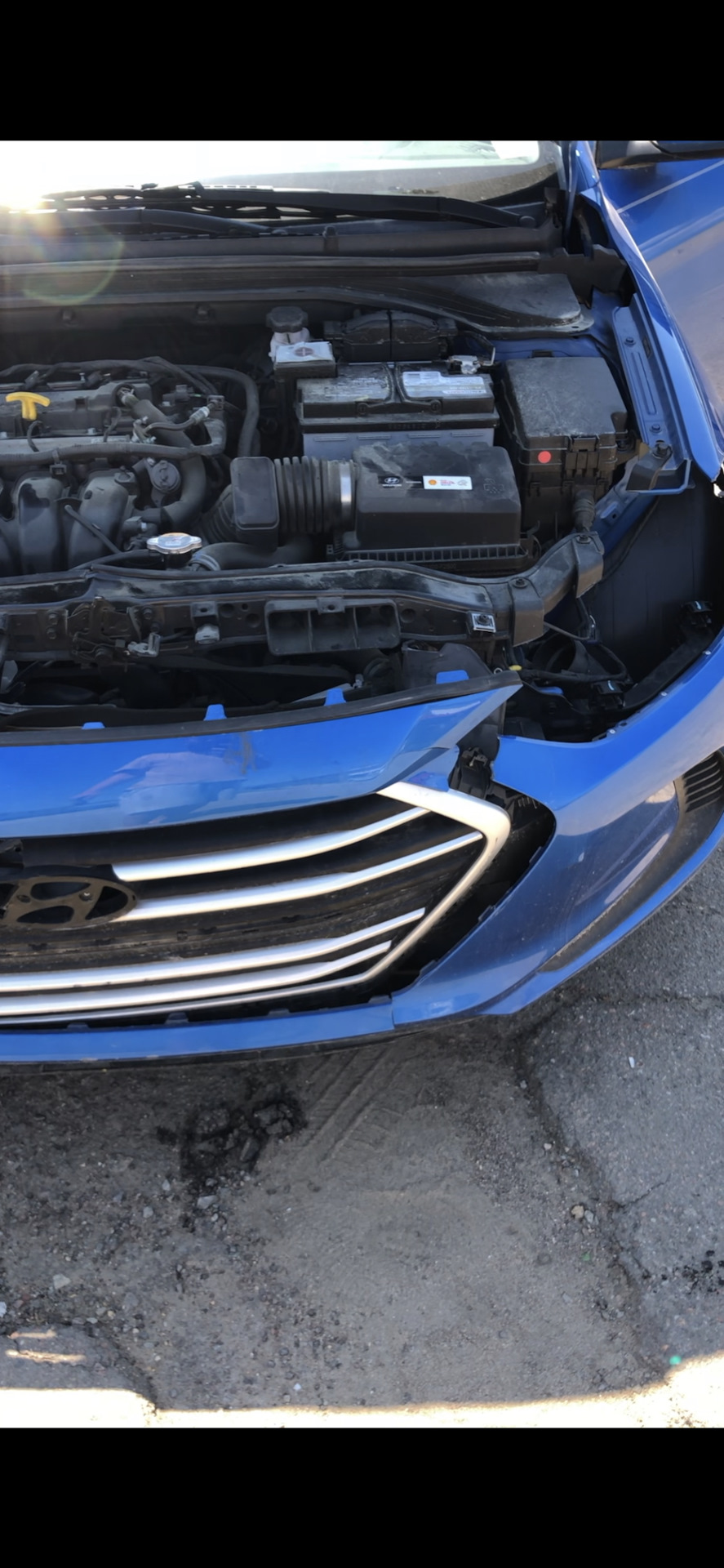 Ремонт Elantra 1