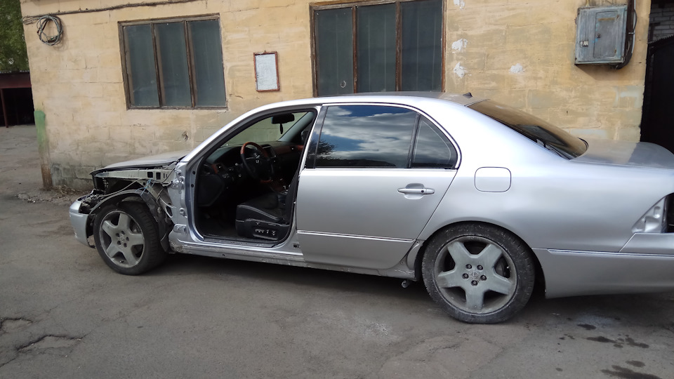 Пластична хірургія лівого боку 1