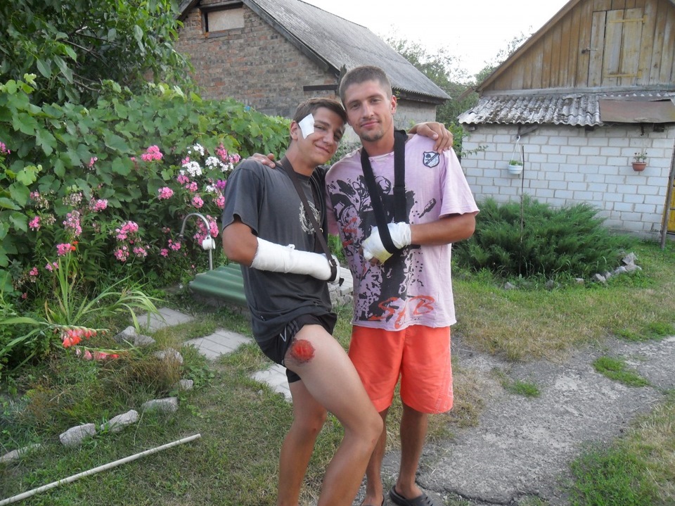 Я без пальця з права 1