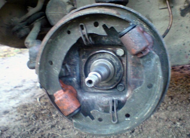 ліпосакція або викид зайвого. 3