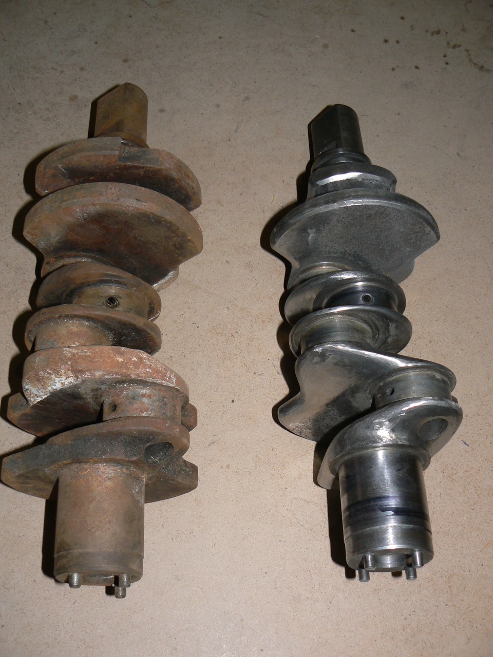 Ліпосакція колінвалу 3