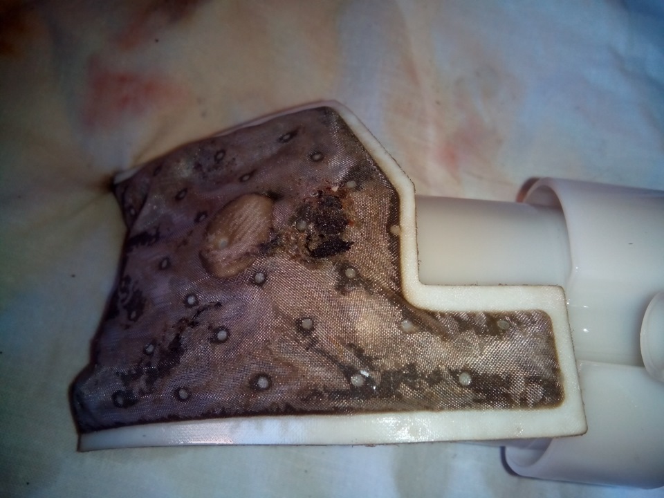 сітка бензонасоса 4